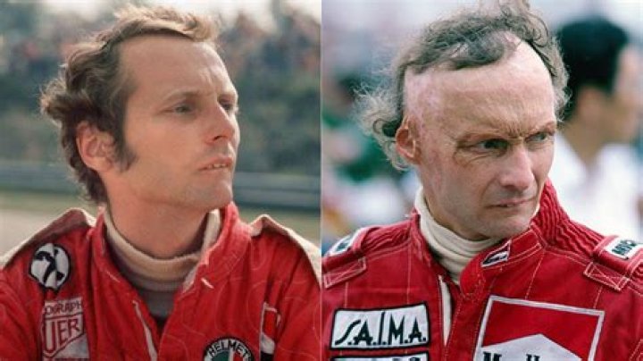 Rush: What Happened To Niki Lauda? Death Cause -Everything To Know About The Austrian Formula 1 Driver